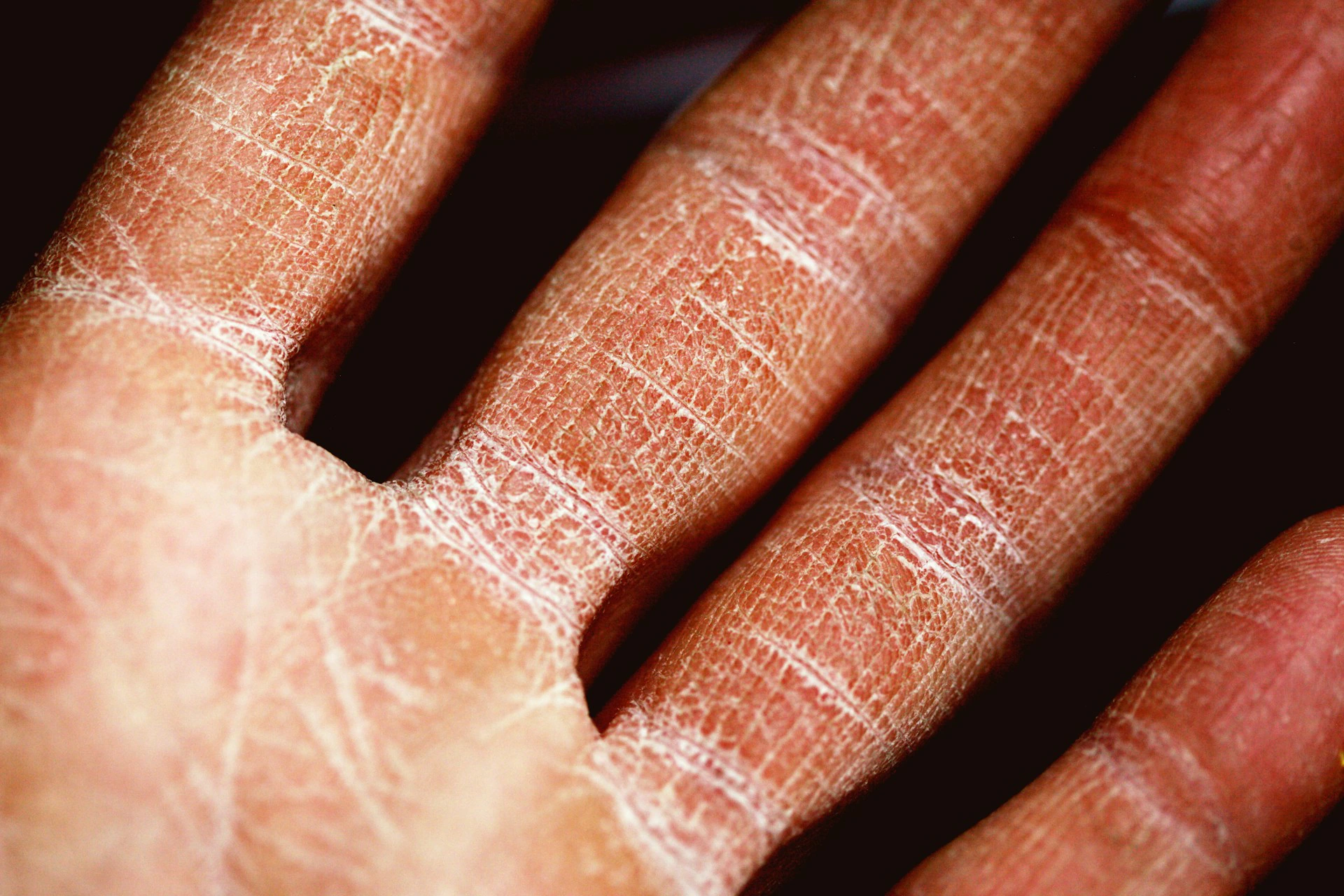 Dermatologische Untersuchung bei Ekzemen